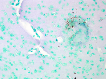 Cav1.2 Antibody (PerCP)