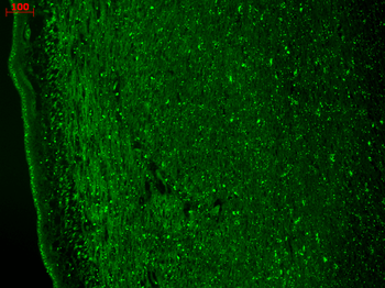 Cav3.2 Antibody (FITC)