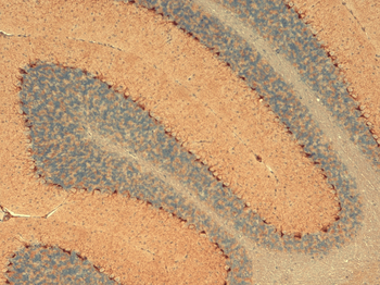 HCN1 Antibody (APC)