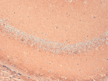 HCN1 Antibody (APC)