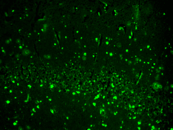 HCN2 Antibody (RPE)