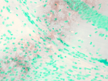 KCNQ1 Antibody (APC)