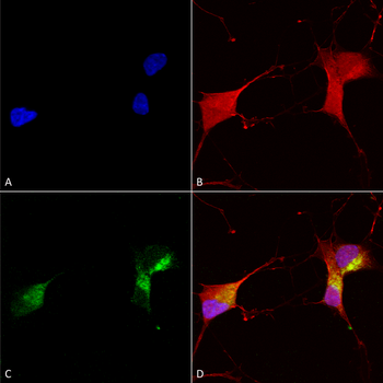 KCNQ1 Antibody (RPE)