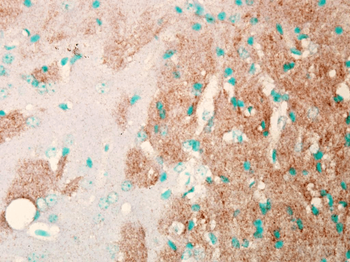 Nav1.7 Antibody (Biotin)