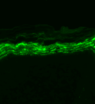 Nav1.7 Antibody (HRP)
