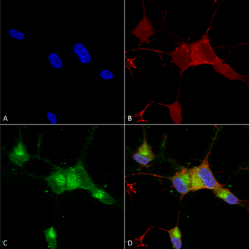 Nav1.7 Antibody (PerCP)