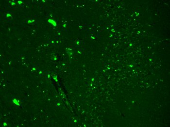 Nav1.7 Antibody (PerCP)