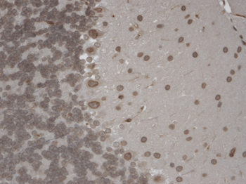 TRPM7 Antibody (Biotin)