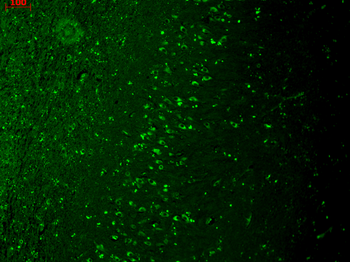 TRPM7 Antibody (FITC)