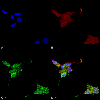 TRPM7 Antibody (HRP)