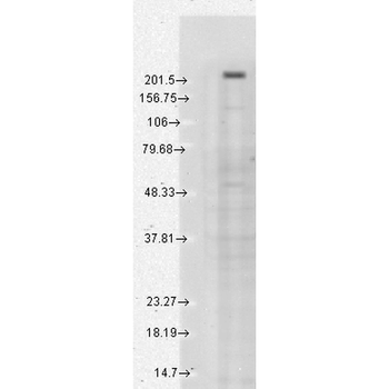 TRPM7 Antibody (HRP)