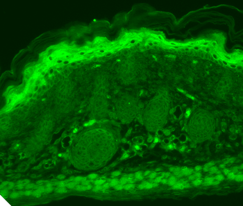 TRPV3 Antibody (Biotin)