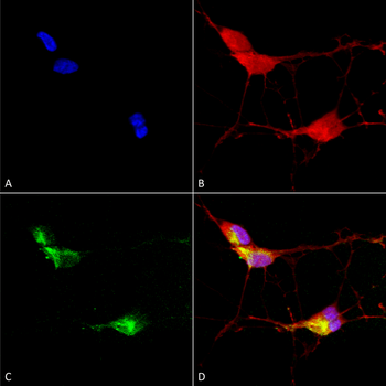 TRPV3 Antibody (FITC)