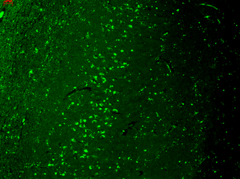 TRPV3 Antibody (FITC)
