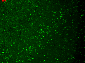 HCN4 Antibody (HRP)