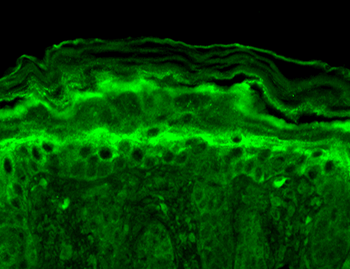 Slo2.2 Antibody (FITC)