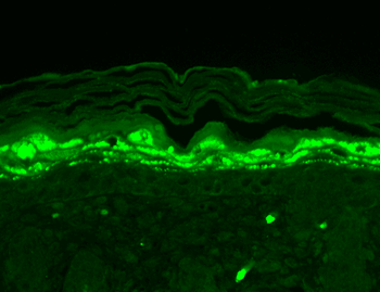 SHANK1 Antibody (HRP)