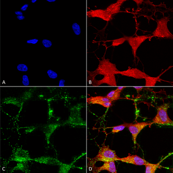 TRPV3 Antibody (FITC)