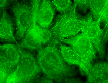 TRPV3 Antibody (FITC)