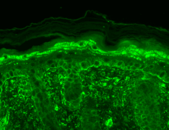 TRPV3 Antibody (RPE)