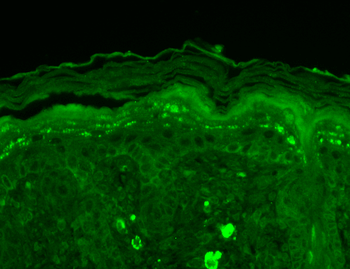 SHANK3 Antibody (HRP)