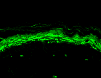 Nav1.8 Antibody (FITC)