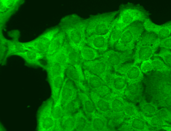 Nav1.8 Antibody (RPE)