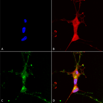 TRPC7 Antibody (APC)