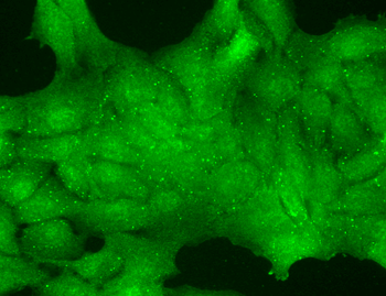 TRPC7 Antibody (FITC)