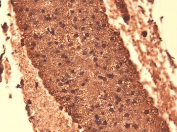 Sodium Iodide Symporter Antibody (APC)