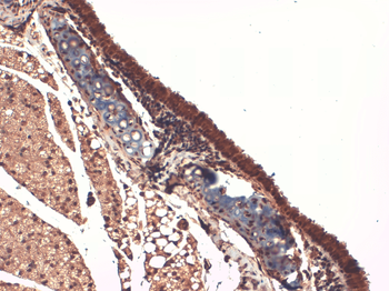 Sodium Iodide Symporter Antibody (APC)