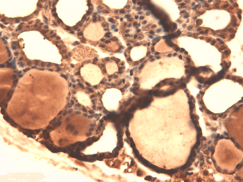 Sodium Iodide Symporter Antibody (APC)
