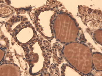 Sodium Iodide Symporter Antibody (APC)