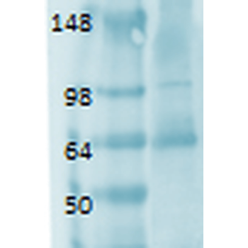 Sodium Iodide Symporter Antibody (APC)