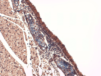 Sodium Iodide Symporter Antibody (APC)