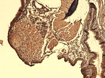 Sodium Iodide Symporter Antibody (APC)