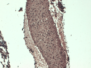 Sodium Iodide Symporter Antibody (Biotin)