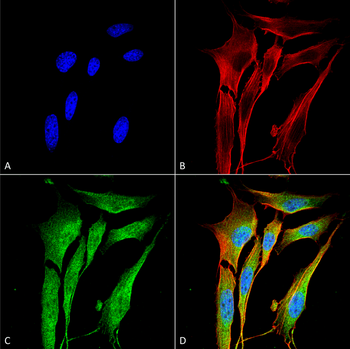 VAChT Antibody (APC)