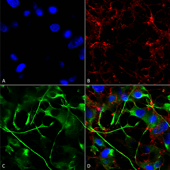 VAChT Antibody (HRP)
