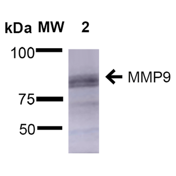 MMP9 Antibody (APC)