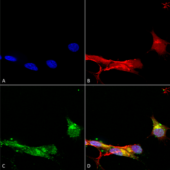 mGluR5 Antibody (FITC)