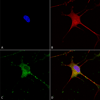 SUR1 Antibody (Biotin)