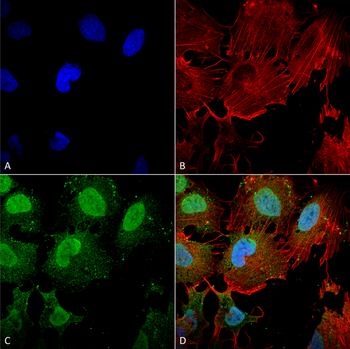 mGluR5 Antibody (HRP)