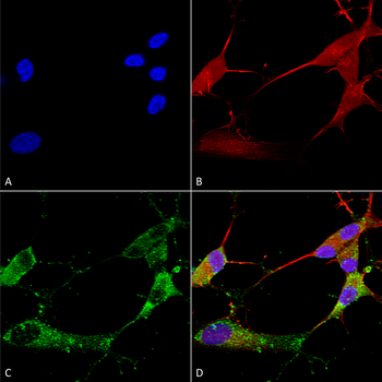 Stargazin Antibody (HRP)