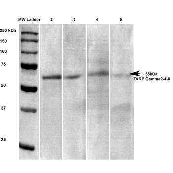 Stargazin Antibody (RPE)