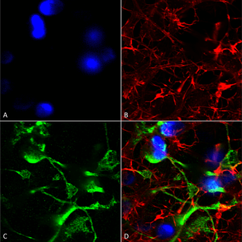 SUR2A Antibody (Biotin)