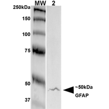 GFAP Antibody (Biotin)