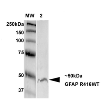 GFAP Antibody (Biotin)