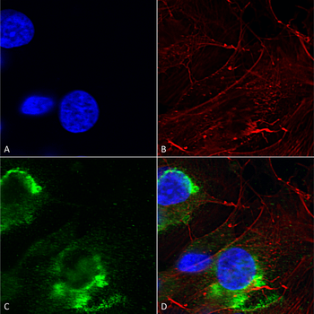 GFAP Antibody (FITC)