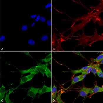 LRRK2 Antibody (RPE)
